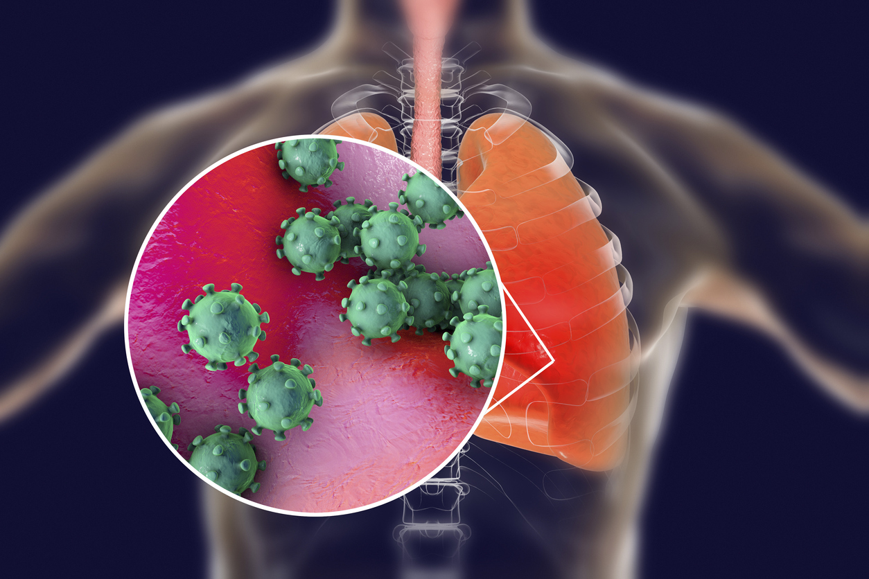 coronovirus-infection-outbreak-update