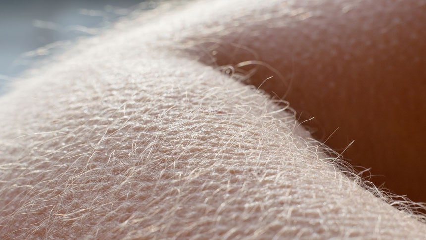 Hair and skin