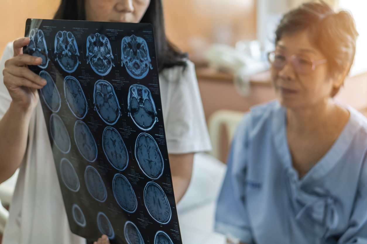 Brain disease diagnosis with medical doctor diagnosing elderly ageing patient neurodegenerative illness problem seeing Magnetic Resonance Imaging (MRI) film for neurological medical treatment stock photo