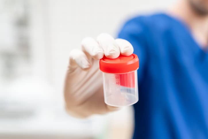 Male fertility tests