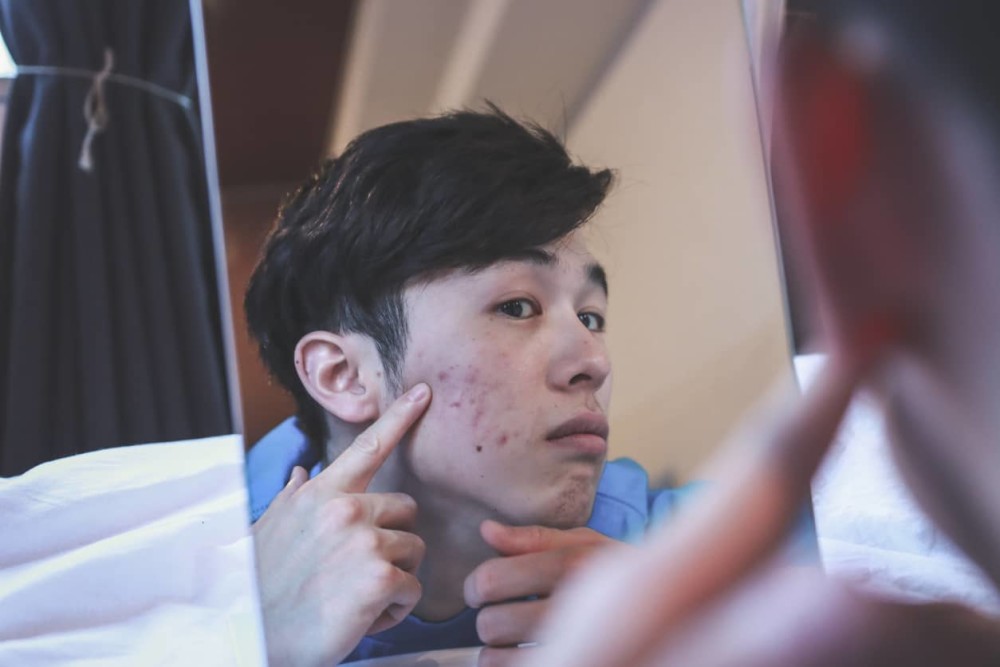 Person with acne looking at face in the mirror wondering does masturbation cause acne