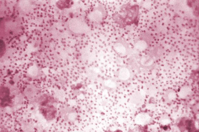 Photomicrograph of a tissue smear specimen showing the presence of Yersinia pestis bacteria, the pathogen responsible for causing plague. Photo credit: CDC