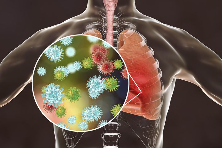 Viruses in human lungs, 3D illustration, conceptual image for flu, MERS-CoV and SARS