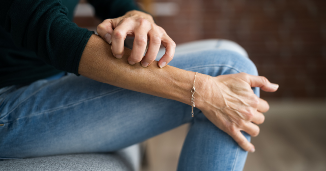 Dry itchy skin is a symptom of the menopause and perimenopause